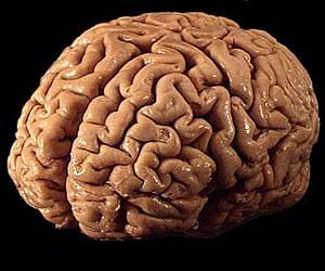 human-brain-pink-300-lg.jpg