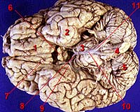 Brain Cross Section